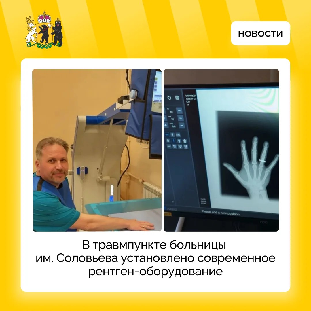 В ярославской больнице им. Соловьева установлен новый цифровой рентген